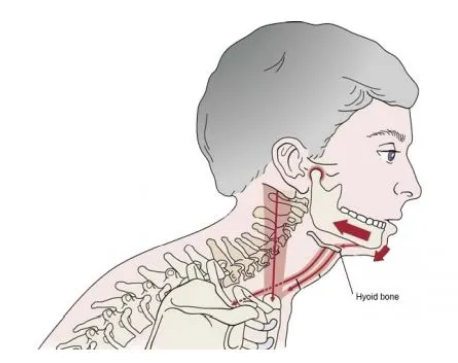 TMJ due to poor posture